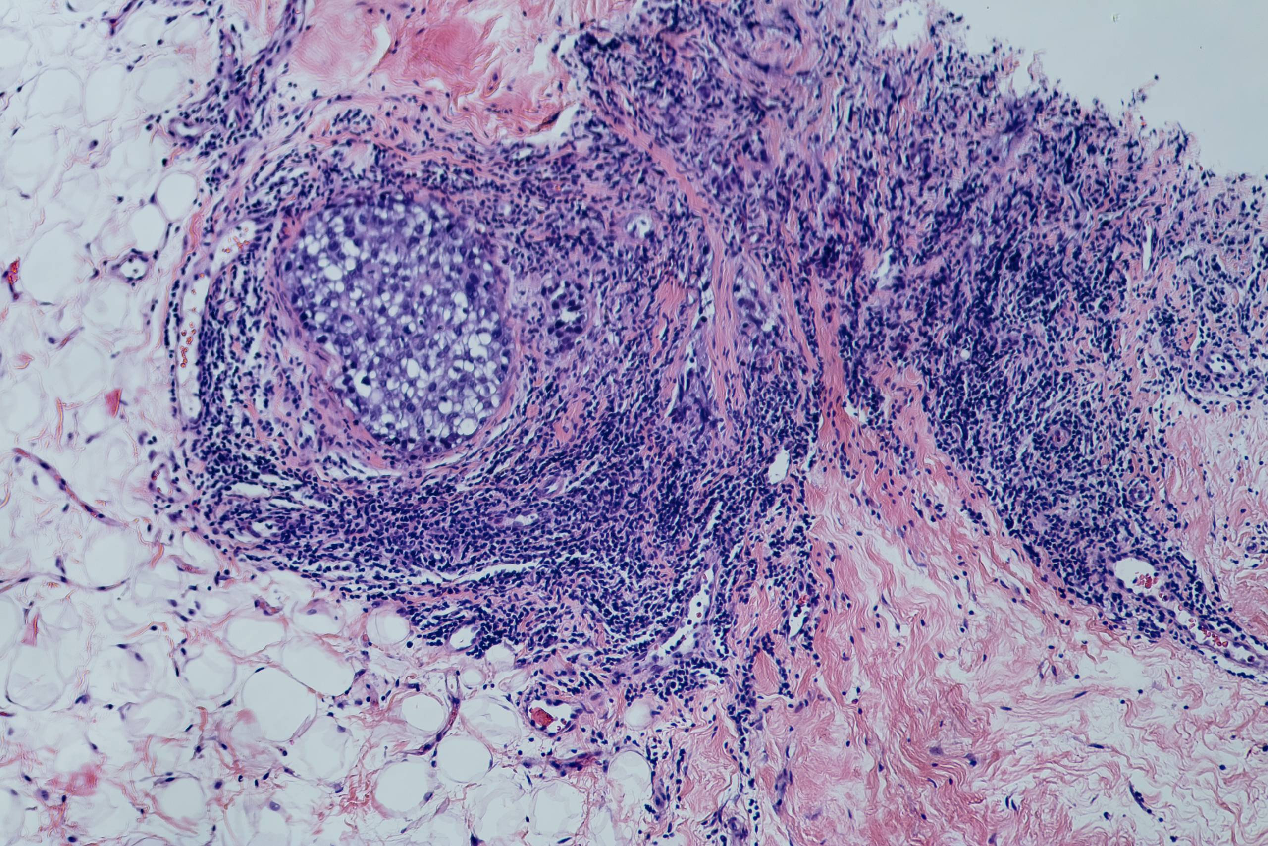 “BRCA1”